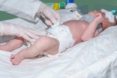 Nurse changing diaper of newborn baby with orthopedic collar and peripheral intravenous catheter in the vein of his head on infant warmer in neonatal intensive care unit at children's hospital.